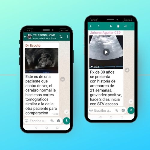 Alcance de la Telesonografía