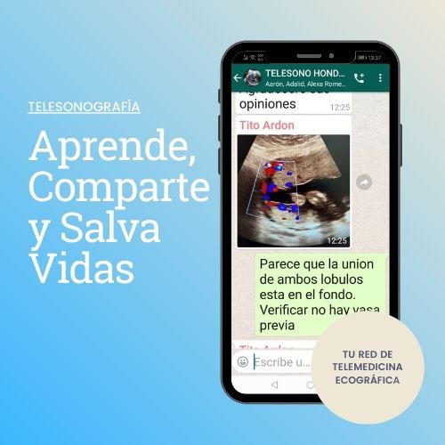 Telesonografía de Ultrasónica